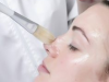 EXO PEEL Thủy Phân Mờ Nám Trắng Sáng